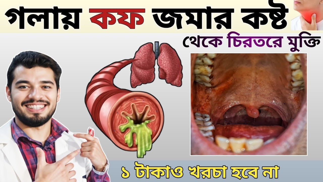 মাত্র ১ টুকরো চিবিয়ে খান গলার কফ আর জমবে না👍গলায় কফ জমলে করণীয়| How to Clear Excess Throat Mucus?
