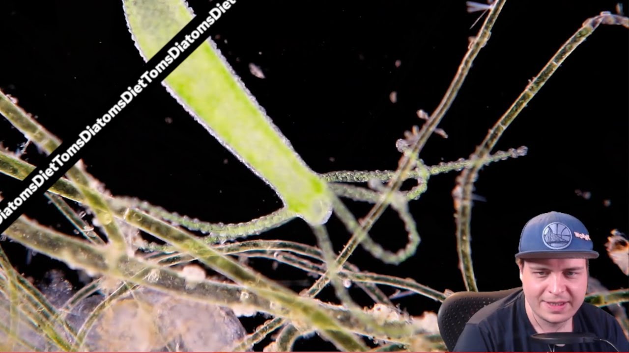 Twitch Microscopy Seminar - 2/3 - Darkfield and Simple Rheinberg Filters