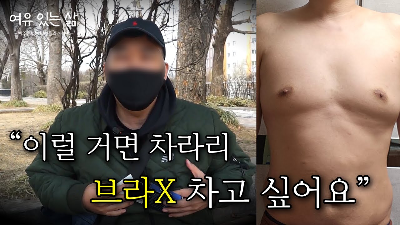 여유증수술 하려고 위절제까지 받은 43세 남성｜리얼 다큐 여유증수술후기 ｜여유(증)있는 삶