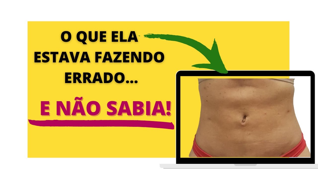 Tratamento para fibroses pós lipo, abdominoplastia: O que ela fazia errado e não sabia!