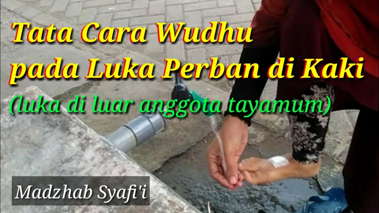 Tata Cara Wudhu pada Luka Perban di Kaki (Sahibul Jabiroh)