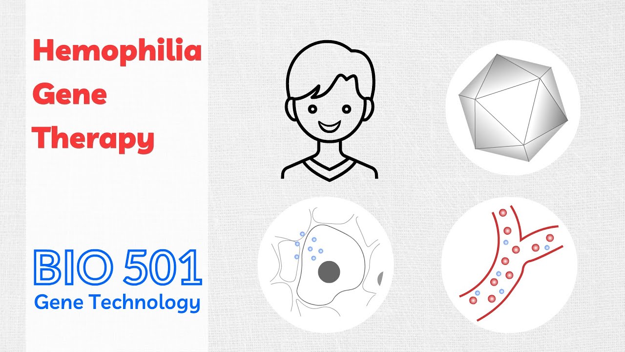 Hemophilia Gene Therapy - One-Off Cure Replacing Factor Injections