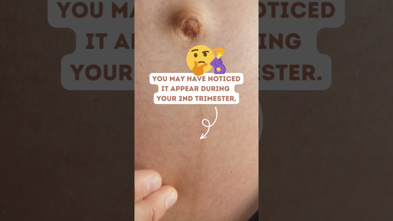 What is this DARK LINE😳on Pregnant Belly? 🧐#shorts