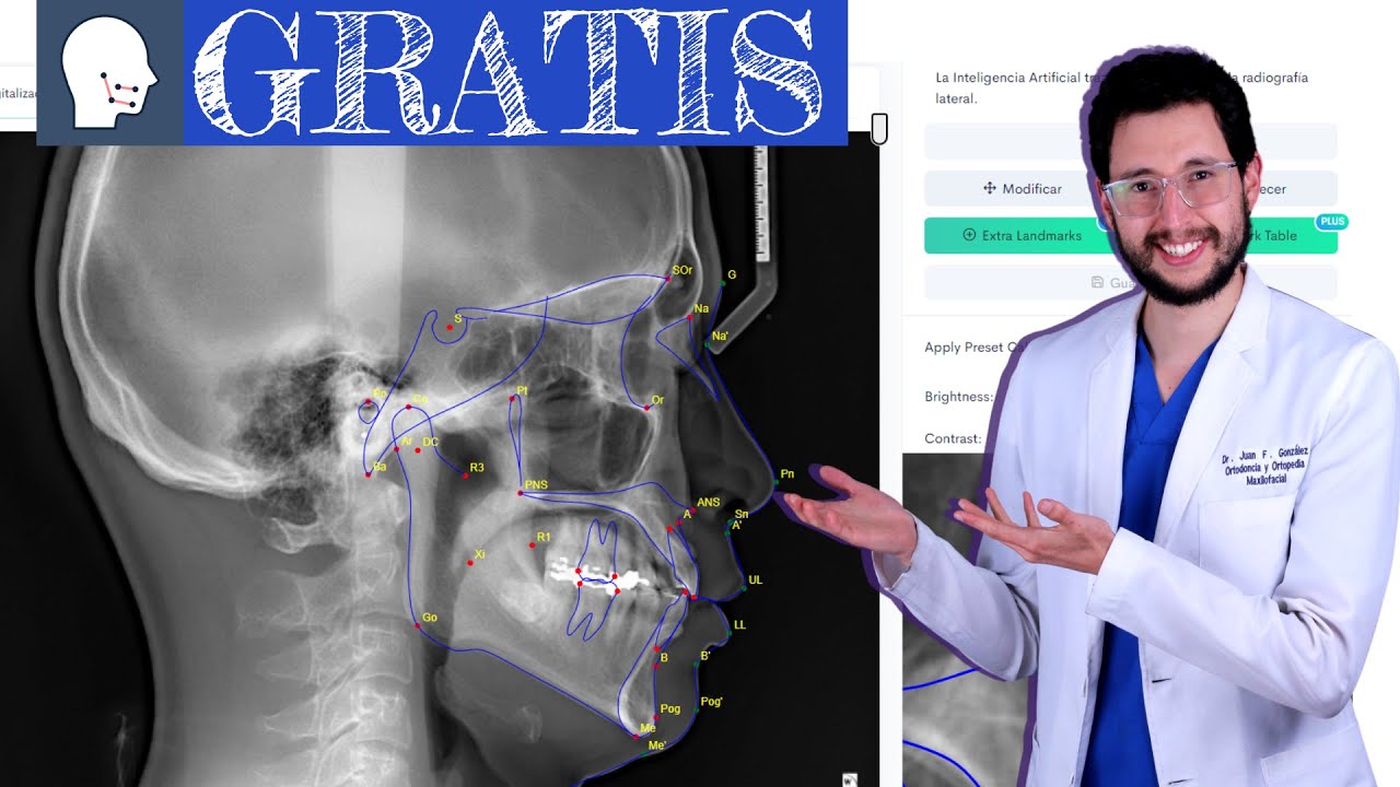 Cefalometría online GRATIS con Inteligencia Artificial 🪄