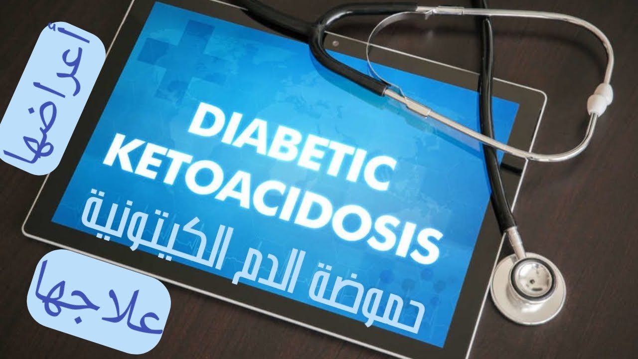 حموضة الدم الكيتونية,أعراضها,كيفية التعامل مع حموضة الدم,DIABETIC KETOACIDOSIS,MANAGEMENT,  DKA