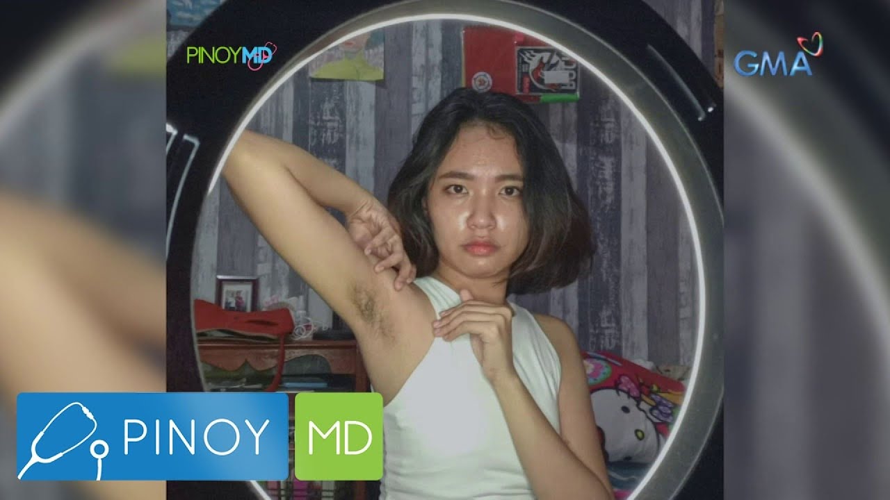 Pinoy MD: Maitim na kili-kili, ano ba ang dahilan at paano ito masosolusyonan?