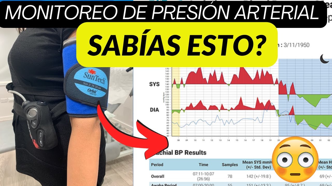 MONITOREO AMBULATORIO PRESION ARTERIAL. explicado FÁCIL ✅💯