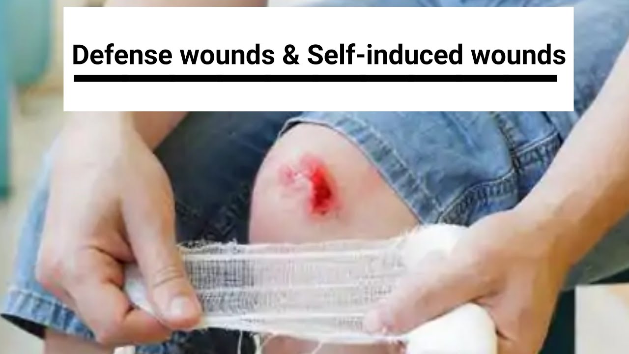 Defense wounds & Self inflicted wounds | Forensic medicine