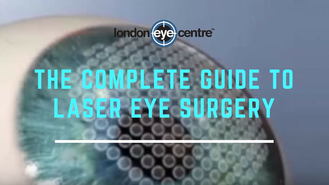 The Complete Guide To Laser Eye Surgery