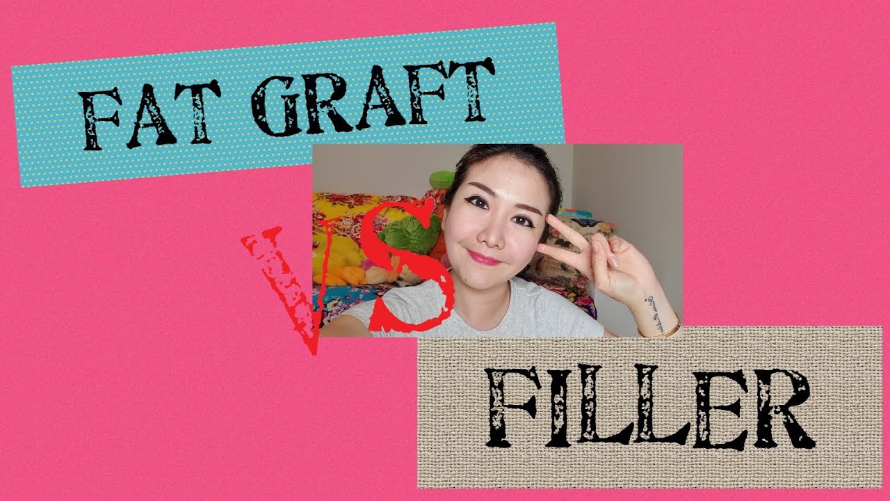 Fat Graft VS Filler | Olivia Rachelina Hans