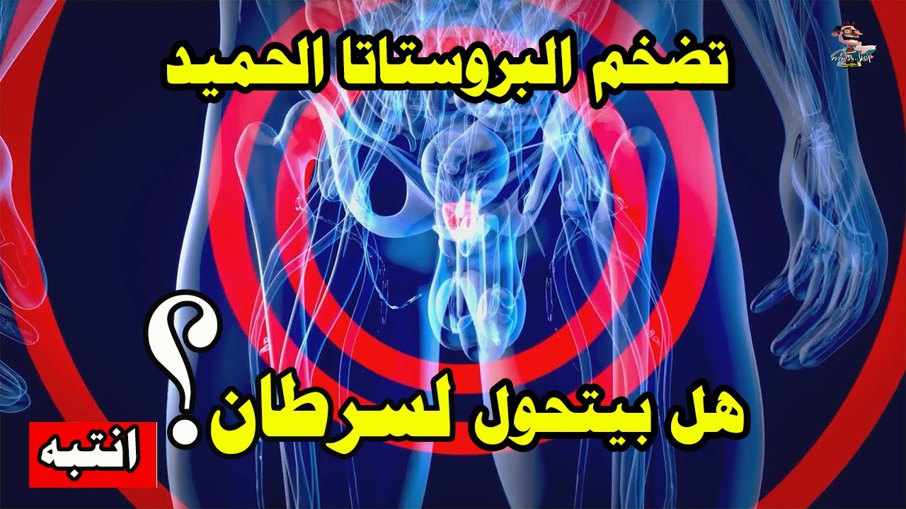 هل ارتفاع PSA يعني سرطان؟ | اهلا يا دكتور تخصص المسالك البولية احتقان البروستاتا