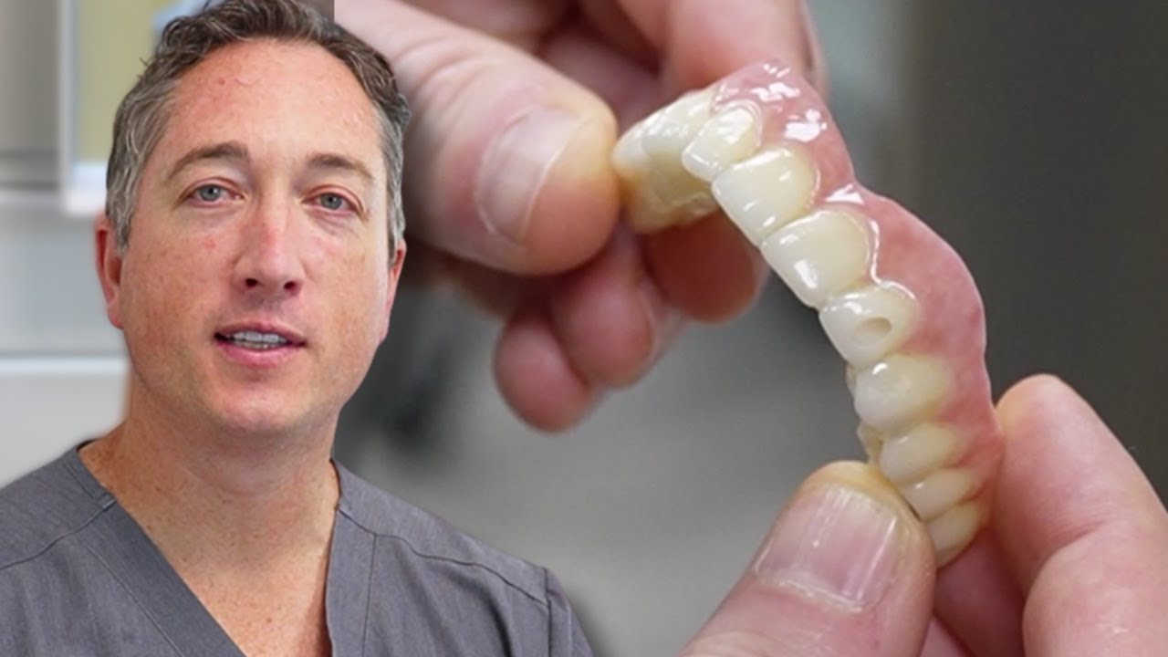 Everything You Need To Know About All-On-X | Fixed Implant Teeth | Implant Dentures | All-On-4