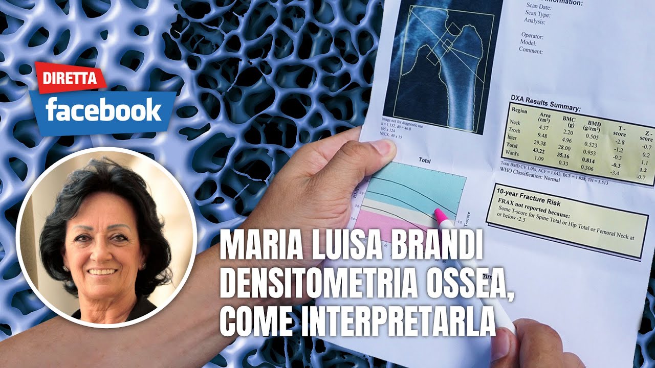Densitometria ossea, come interpretarla