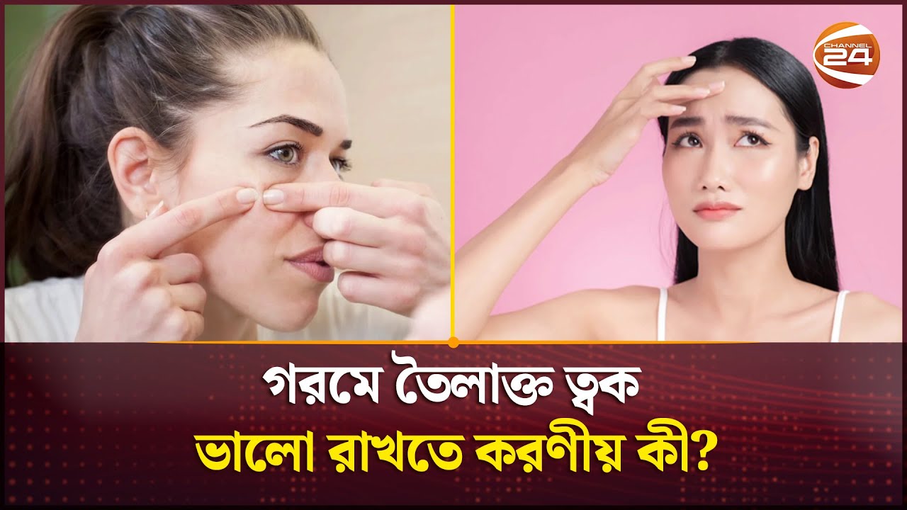 গরমে তৈলাক্ত ত্বক ভালো রাখতে করণীয় কী? | oily skin care | Channel 24