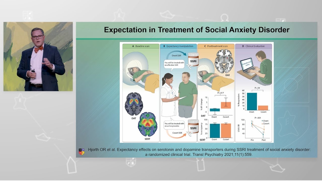 Patient Expectation Impacts Treatment Outcomes