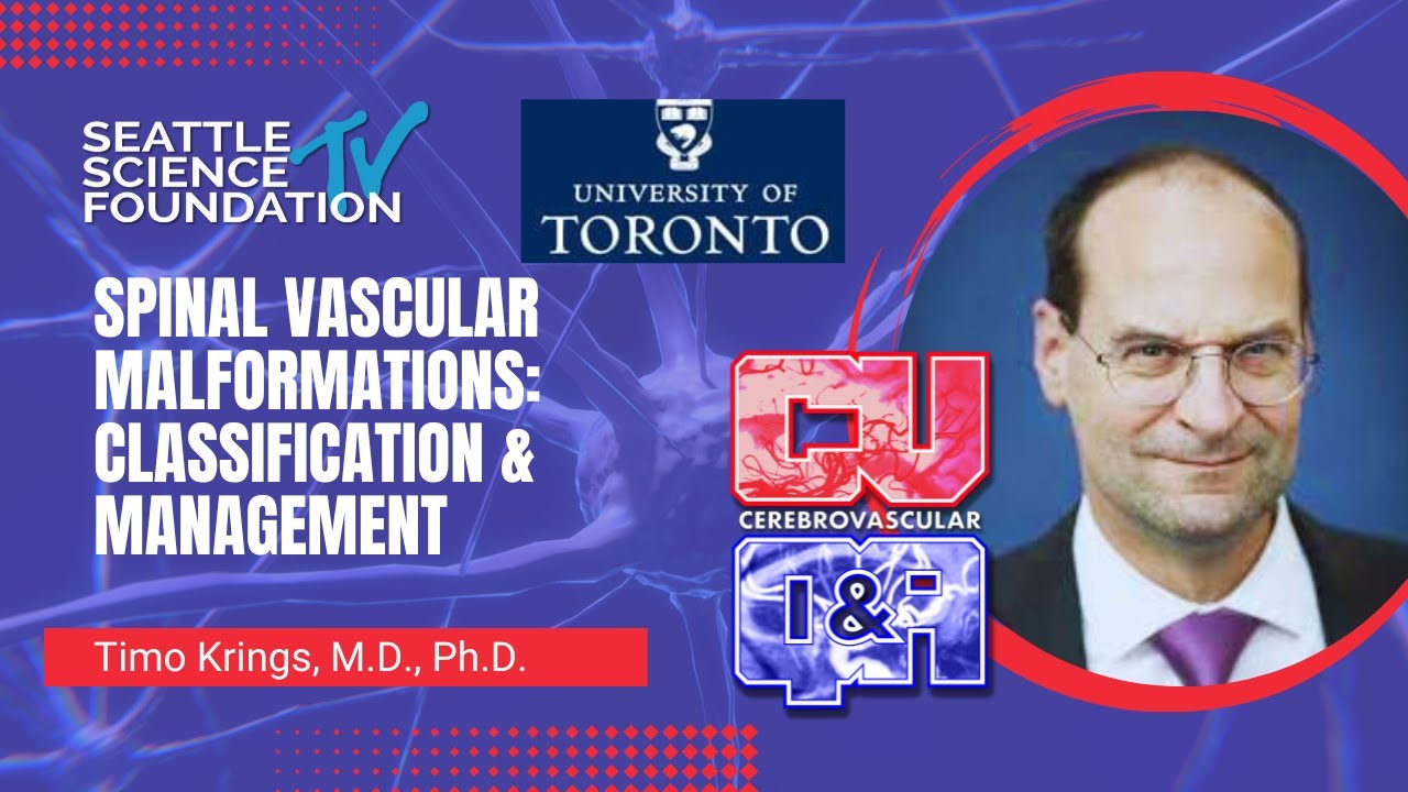 Spinal Vascular Malformations:  Classification & Management - Timo Krings, MD, PhD