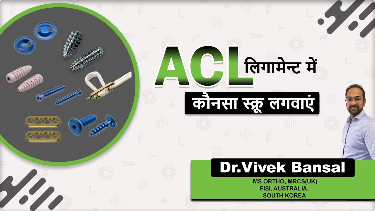 Which Screw to choose for your ACL RECONSTRUCTION SURGERY?