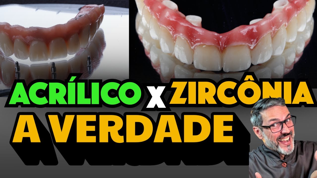 🦷 Zircônia ou Acrílico? A VERDADE sobre a Prótese Protocolo que Ninguém Conta!