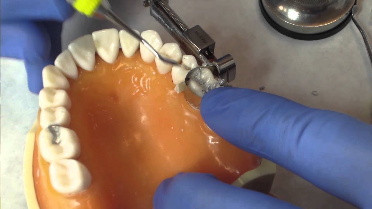 Class II Amalgam Restoration Instructions by Dr  Ywom