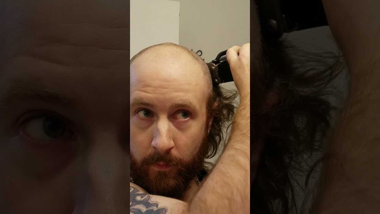 INCREDIBLE NEW LOOK 👀 For This Balding Man