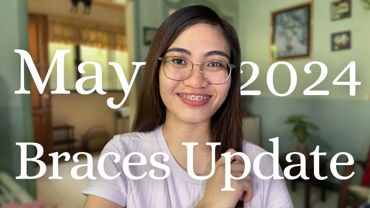 May Braces Update (Part 5/12)