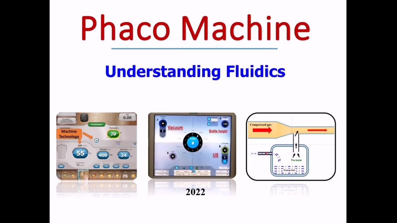 Phaco Machine Fluid Dynamics (#013 )