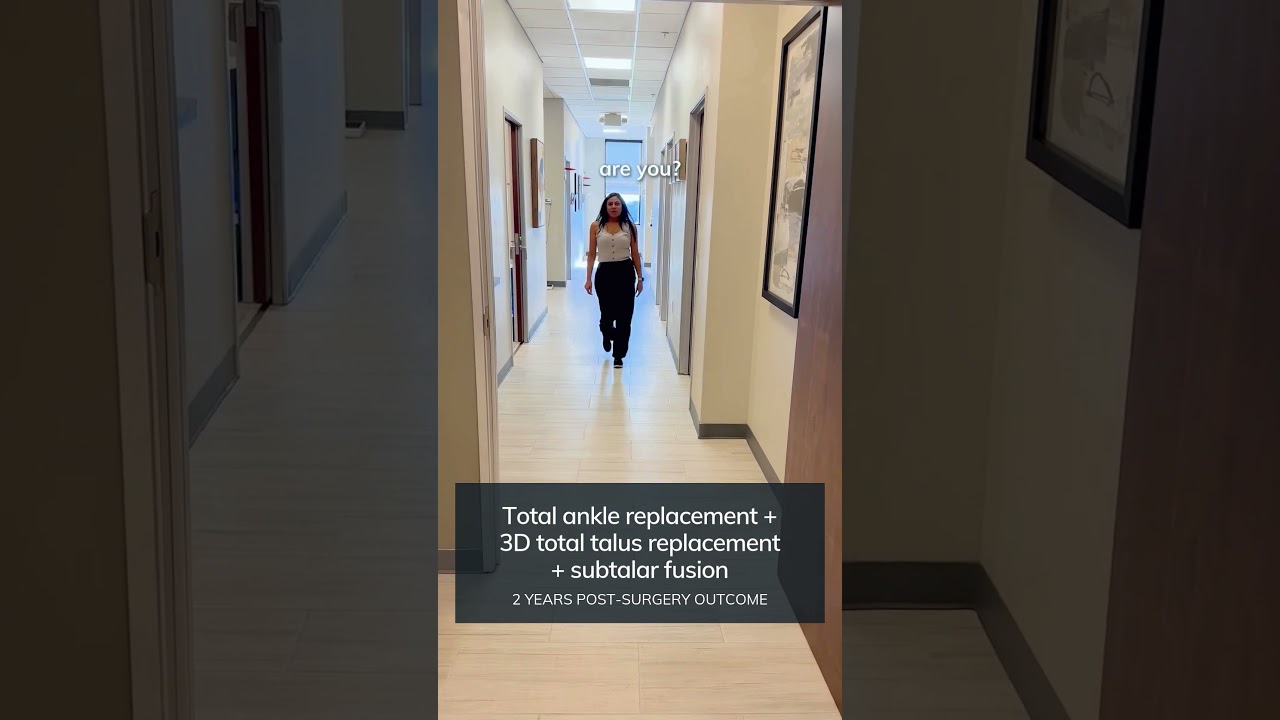 2 years after Total Ankle, 3D Total Talus Replacement and Subtalar Fusion Surgery | Dr. Justin Kane