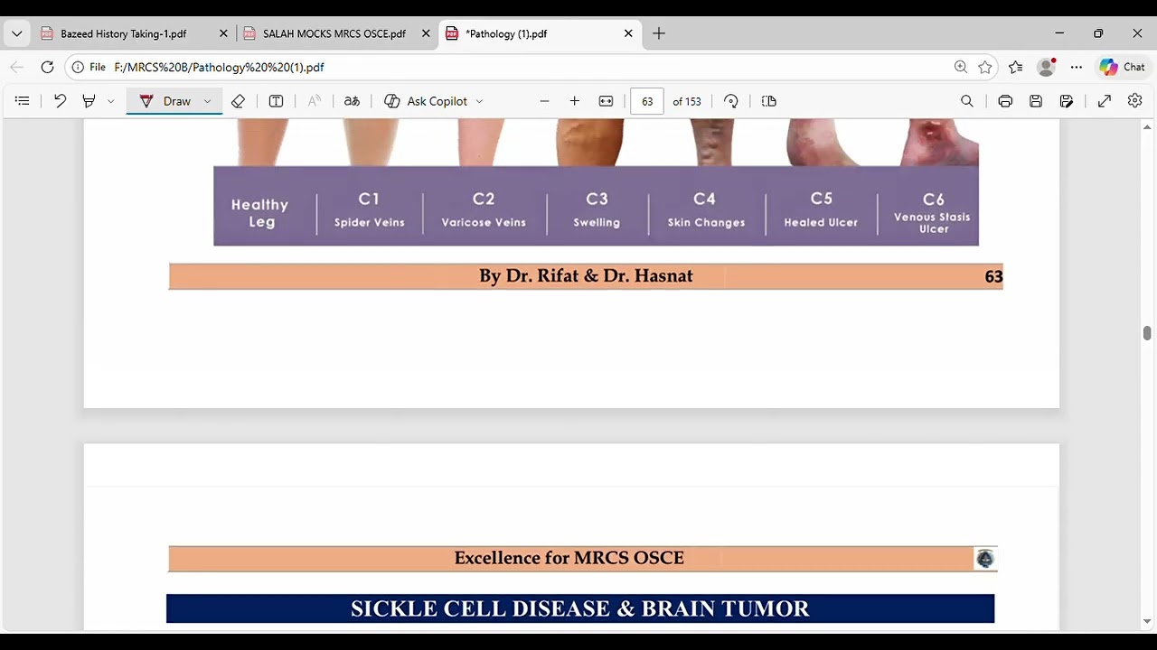 HCV virus for MRCS B#mrcsbites #mrcsbullets #criticalcare #pathology #mrcspartb #mrcspreparation