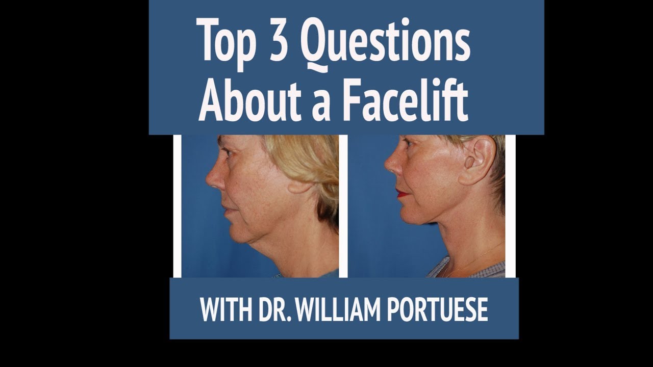 Top 3 Questions for Face & Neck Lift + Before & After Photos by Dr. Bill Portuese - Seattle