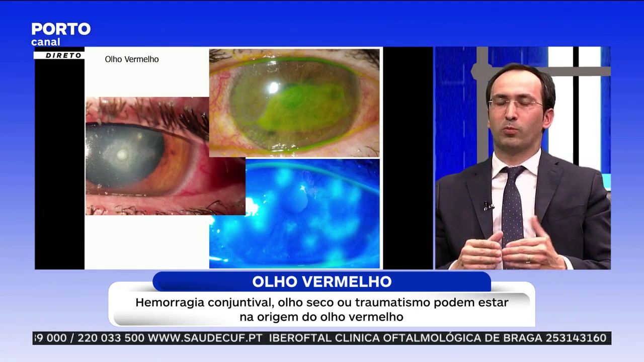 Olho vermelho  |  Dr. João Pinheiro Costa