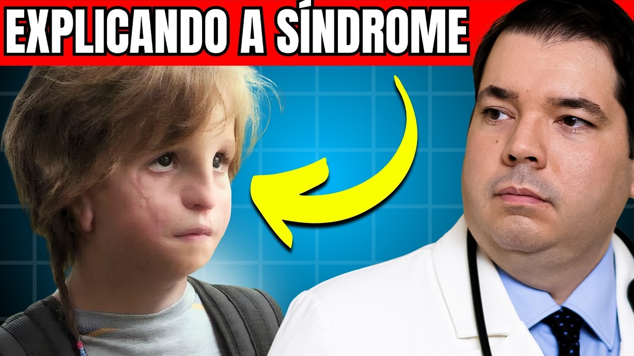 Síndrome de Treacher Collins: A Verdade Por Trás do Filme Extraordinário