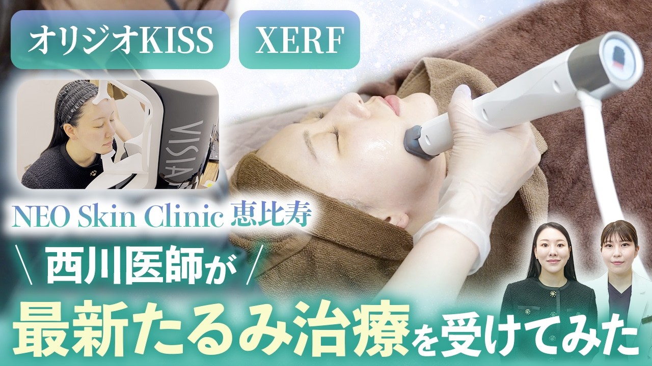 【最新たるみ治療】気になる肌診断から施術まで！XERF＆オリジオKissでたるみ治療をしました