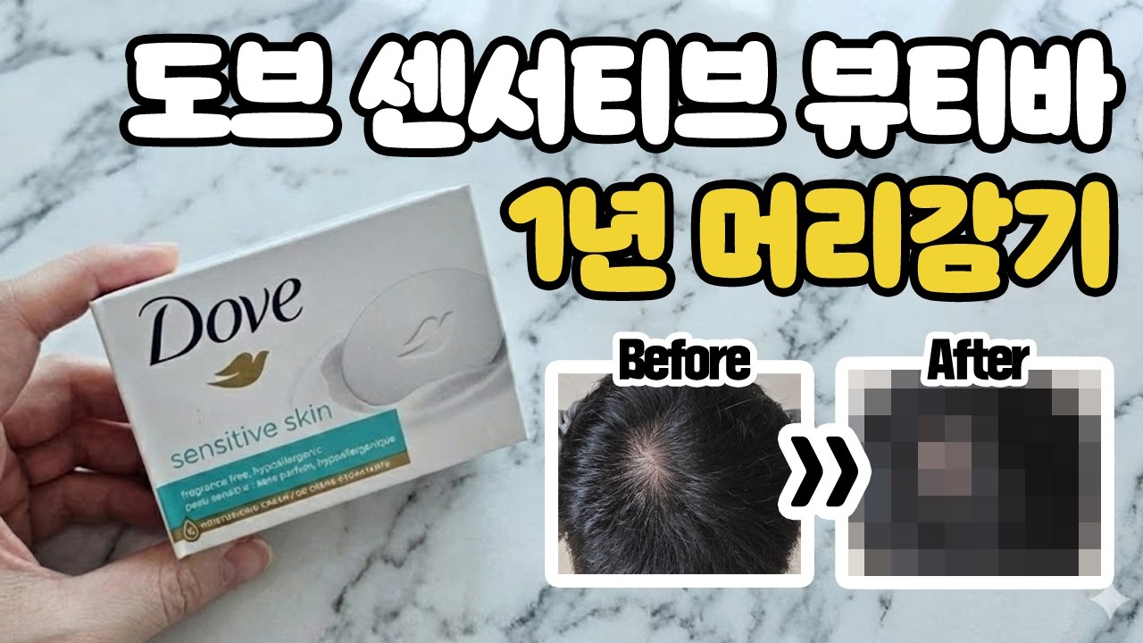 도브 센서티브 뷰티바 1년 머리감기 실험 전후 비교 (탈모 좋아졌을까? 솔직 전후 공개)
