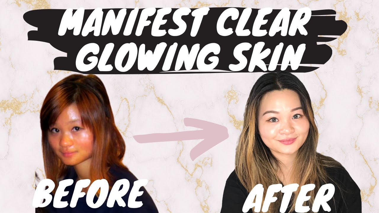 Manifest Clear Skin (Acne GONE! Glowing Skin!) Law of Attraction Technique for Acne