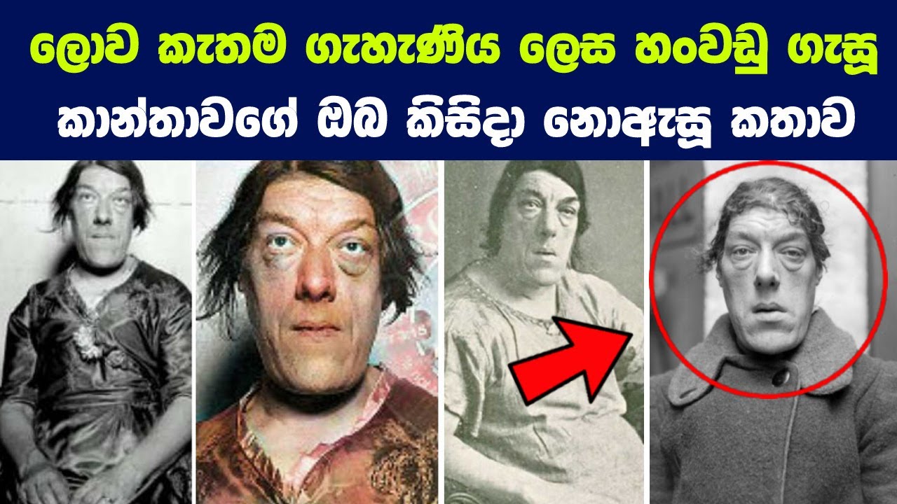 ලොව කැතම ගැහැණිය ලෙස හංවඩු ගැසූ කාන්තාව ගැන ඔබ කිසිදා නොඇසූ ධෛර්යවන්ත කතාව |Story of Mary Ann Bevan