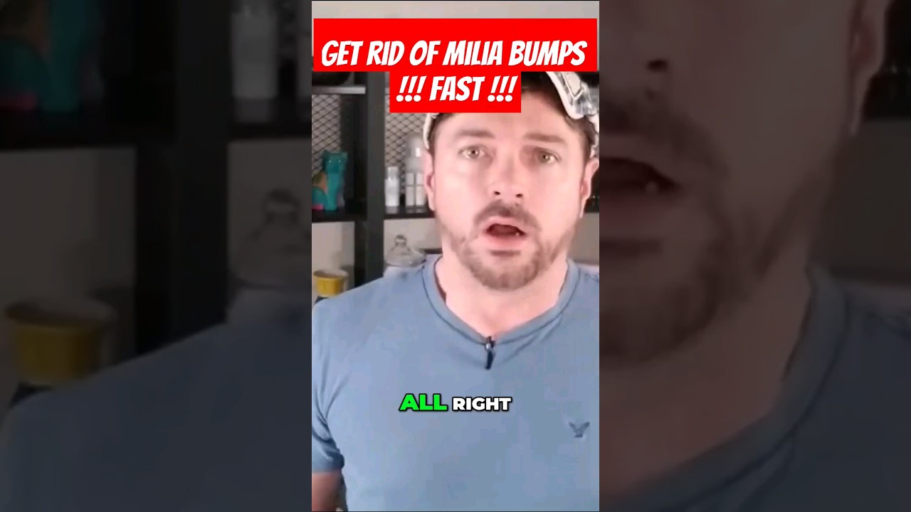 ЛЕЧЕНИЕ МИЛИИ? Избавьтесь от белых кожных прыщей