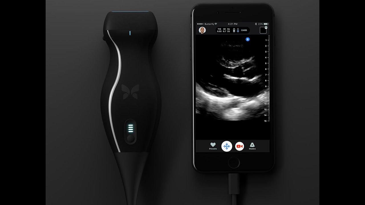 Unboxing Butterfly IQ Probe