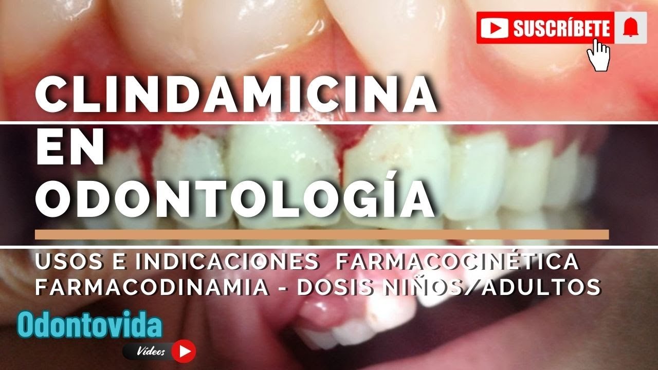 Clindamicina en Odontología