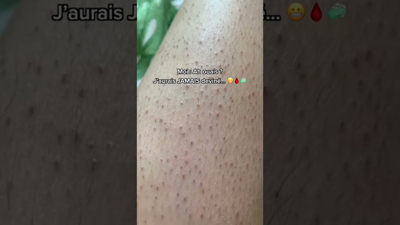 JAMAIS 😬 Les poils incarn&eacute;s et irritations ? Tr&egrave;s peu pour moi ! 😅 #rasoirdesurete #rasoir #poils