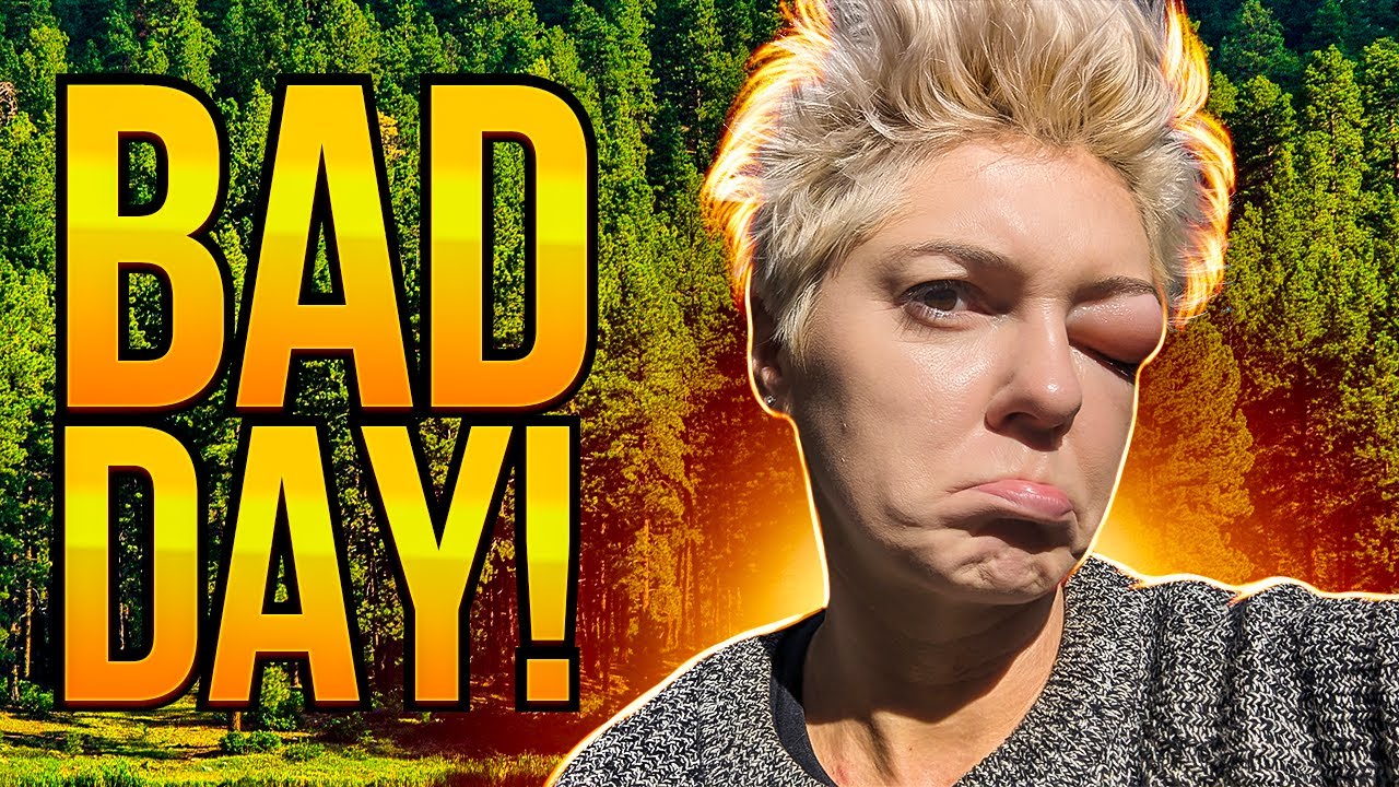 Bad Insect Bite! - EP. 273