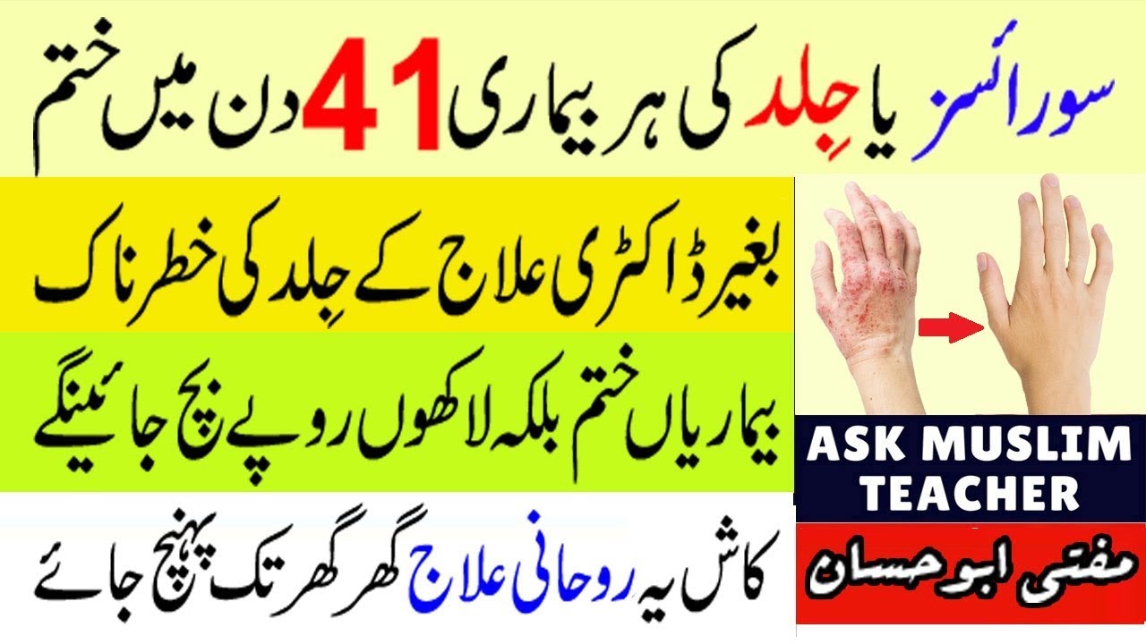 Psoriasis Ka Rohani ilaj - Wazifa for Skin Disease - Chambal Ka Rohani ilaj - Jild ki Bimari ka ilaj
