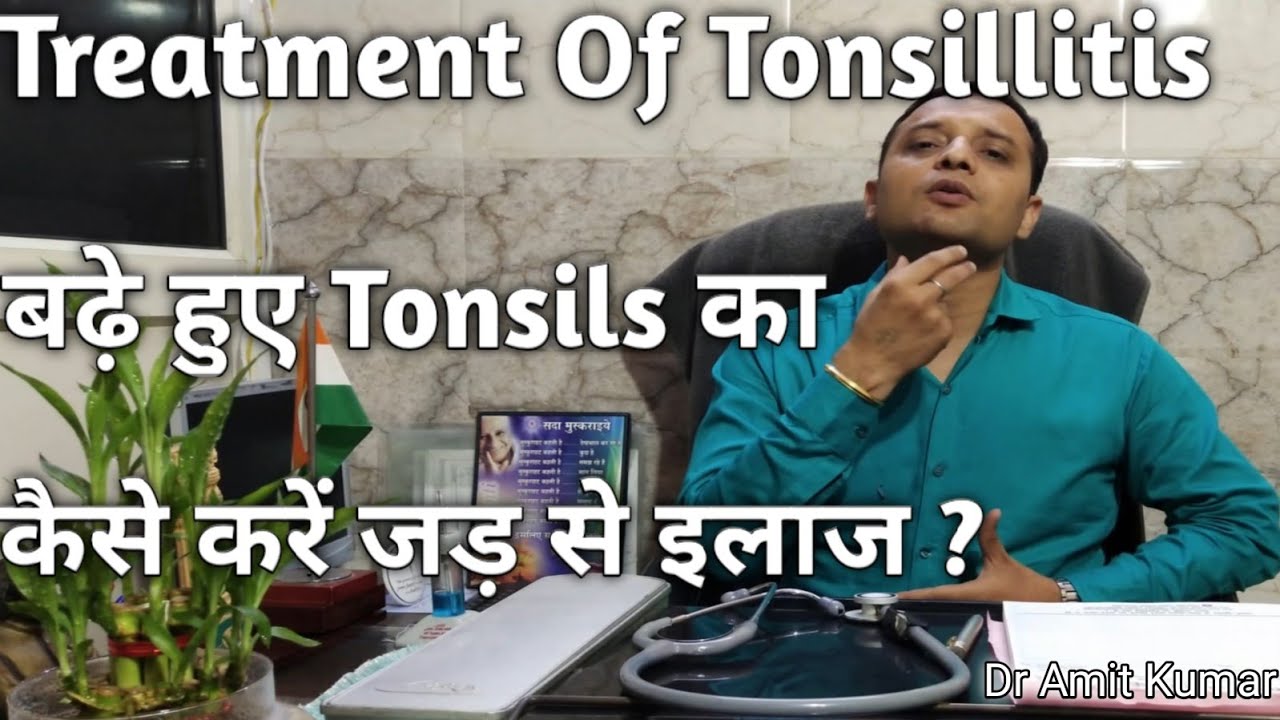 Treatment Of Tonsillitis | बढ़े हुए Tonsils का कैसे करें जड़ से इलाज? Tonsils का इलाज।