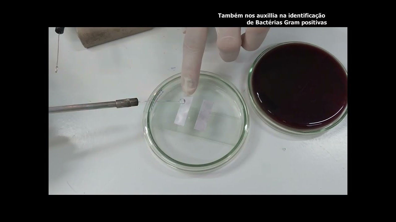 Teste da Catalase, Oxidase e KOH