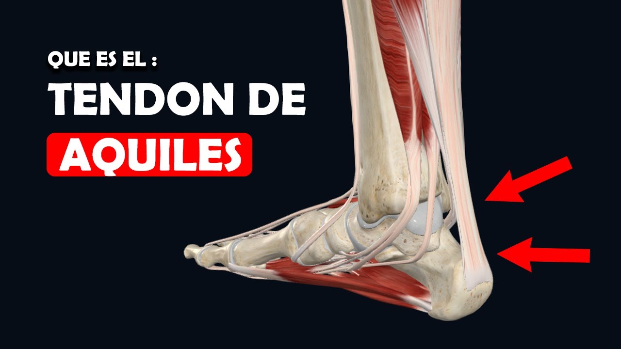 TENDON DE AQUILES: Todo lo que debes saber - Ep. 10