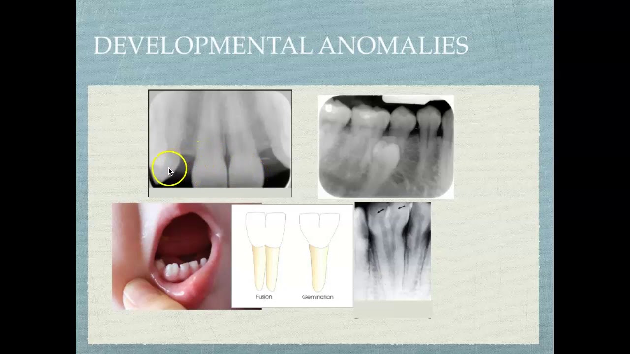 Radiographic Interpretation of Dental Materials, Oral Pathology & Dental Disease