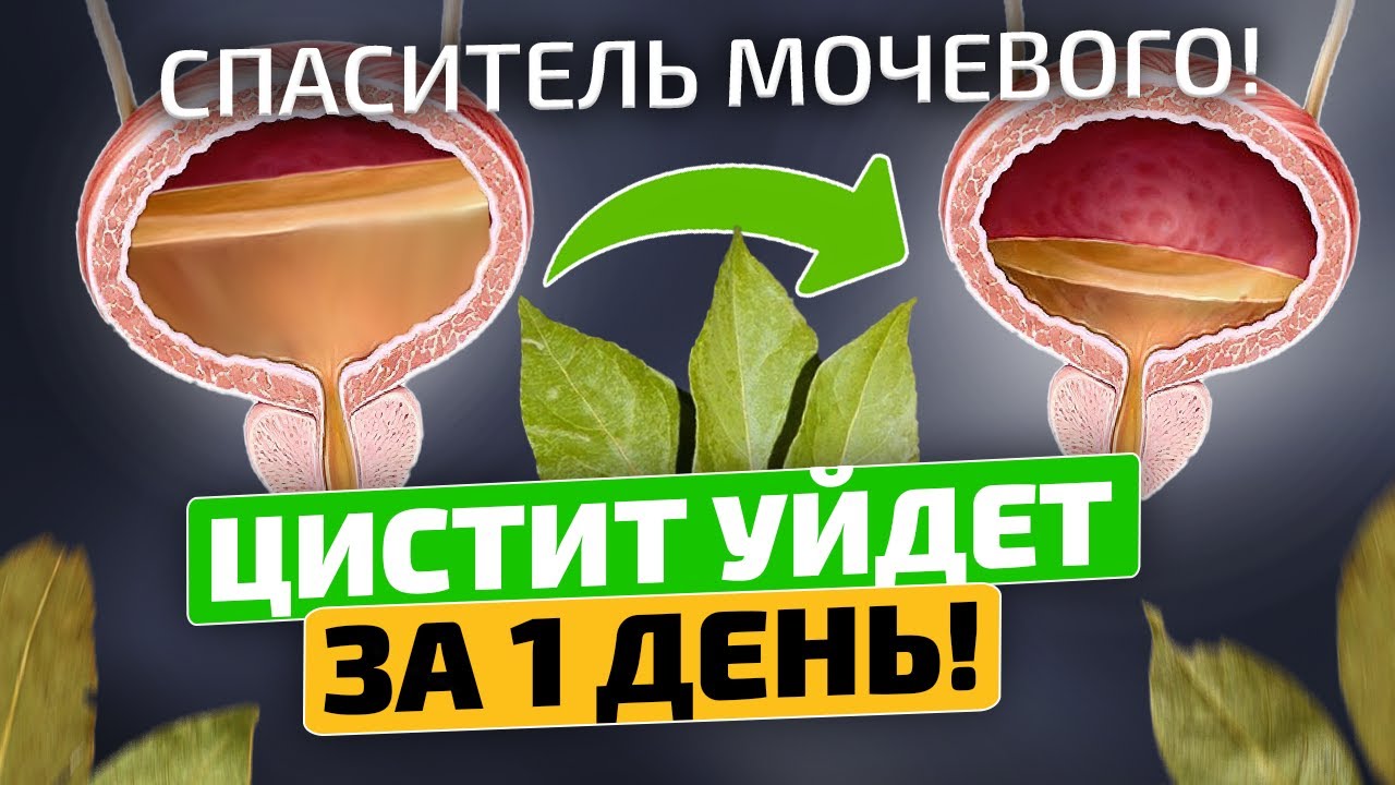 Даже по ночам не бегаю в туалет! От частого мочеиспускания и от цистита спасает...
