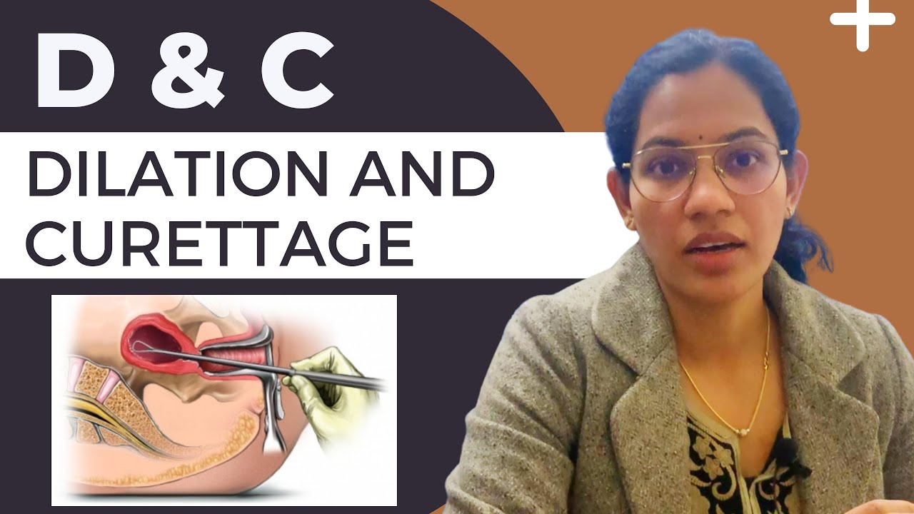 Dilation and curettage# D &C #Do's & Dont's after D&C #D&E  FAQs