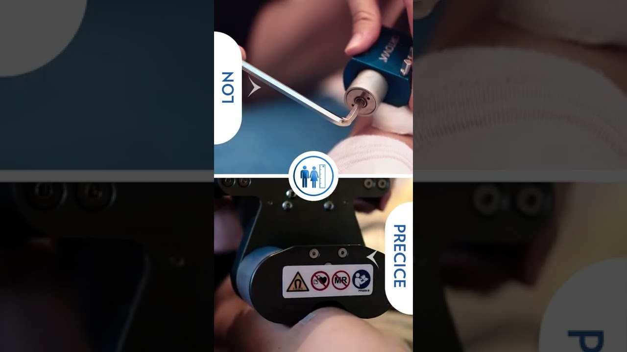 Lengthening Techniques in Limb Lengthening Surgery