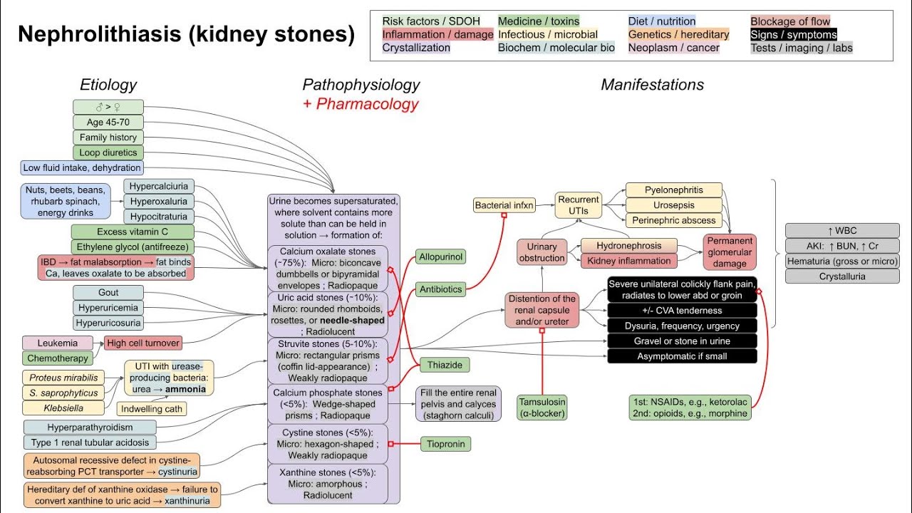 Kidney stones (nephrolithiasis) (mechanism of disease)