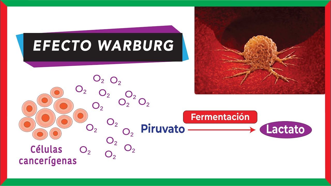 Metabolismo del c&aacute;ncer | Efecto Warburg (gluc&oacute;lisis aer&oacute;bica)